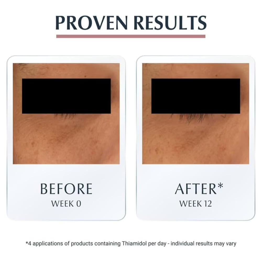 Eucerin Anti-Pigment Dark Circle Eye Corrector – 15ml